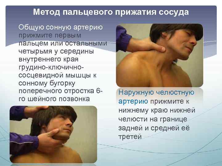 Метод пальцевого прижатия сосуда Общую сонную артерию прижмите первым пальцем или остальными четырьмя у