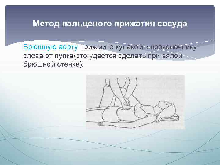 Метод пальцевого прижатия сосуда Брюшную аорту прижмите кулаком к позвоночнику слева от пупка(это удаётся