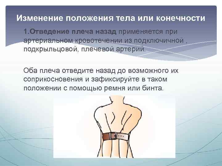 Изменение положения тела или конечности 1. Отведение плеча назад применяется при артериальном кровотечении из