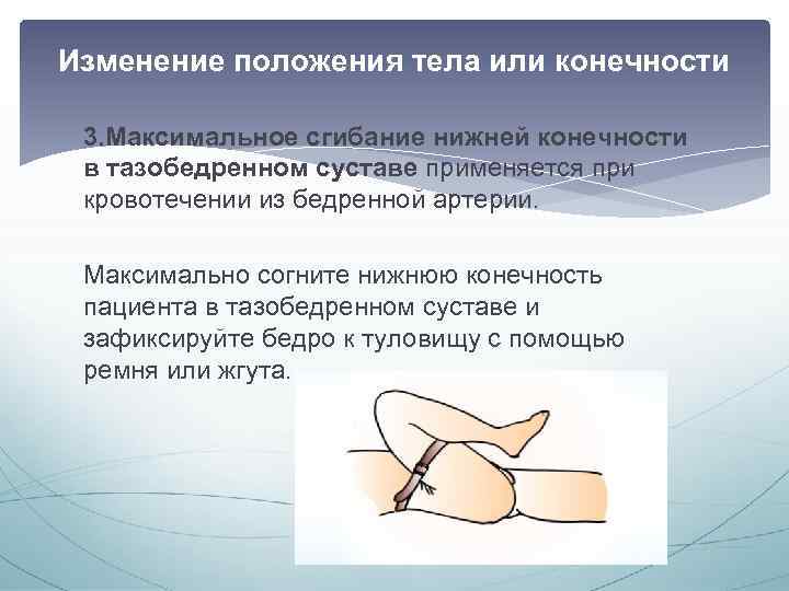 Изменение положения тела или конечности 3. Максимальное сгибание нижней конечности в тазобедренном суставе применяется