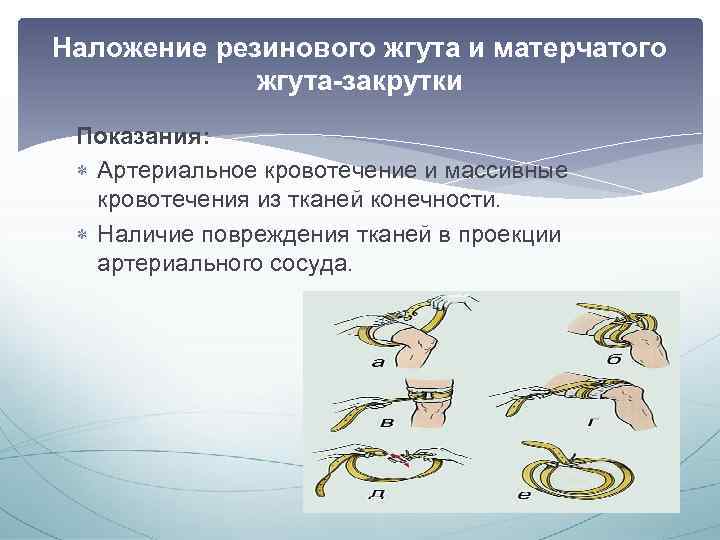 Наложение резинового жгута и матерчатого жгута-закрутки Показания: Артериальное кровотечение и массивные кровотечения из тканей