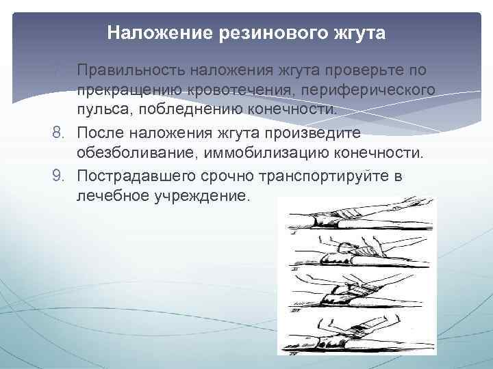 Наложение резинового жгута 7. Правильность наложения жгута проверьте по прекращению кровотечения, периферического пульса, побледнению