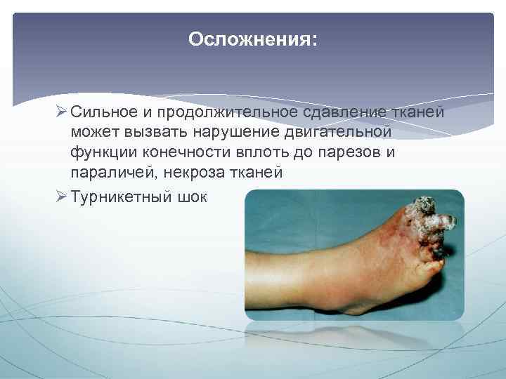 Осложнения: Ø Сильное и продолжительное сдавление тканей может вызвать нарушение двигательной функции конечности вплоть