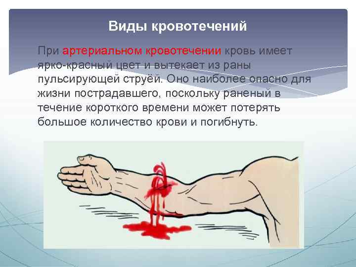 Виды кровотечений При артериальном кровотечении кровь имеет ярко-красный цвет и вытекает из раны пульсирующей