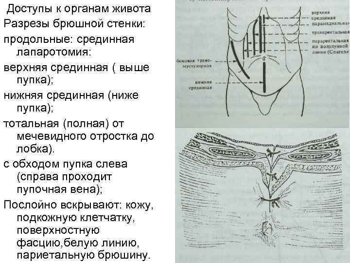 Доступы через переднюю брюшную стенку схема