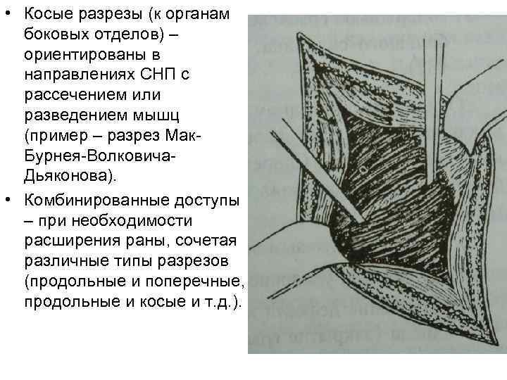  • Косые разрезы (к органам боковых отделов) – ориентированы в направлениях СНП с