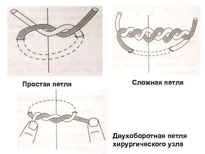 Простая петля Сложная петля Двухоборотная петля хирургического узла 