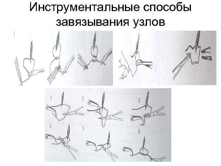 Инструментальные способы завязывания узлов 