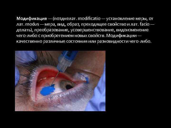 Модификация — (позднелат. modificatio — установление меры, от лат. modus — мера, вид, образ,