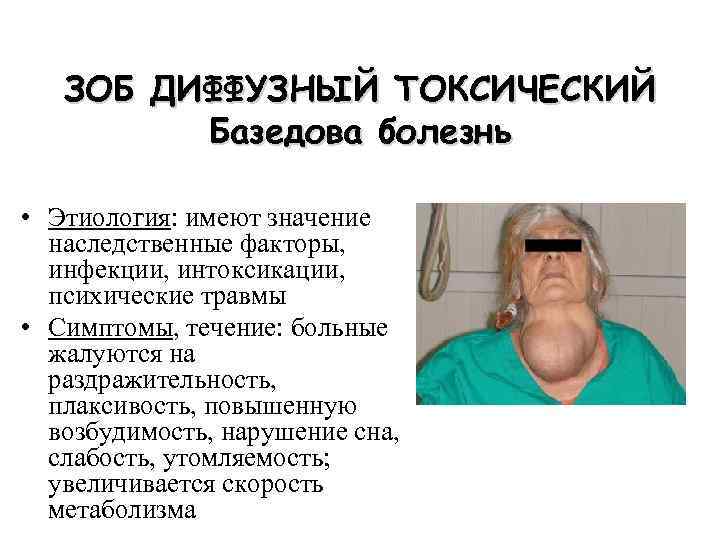 ЗОБ ДИФФУЗНЫЙ ТОКСИЧЕСКИЙ Базедова болезнь • Этиология: имеют значение наследственные факторы, инфекции, интоксикации, психические