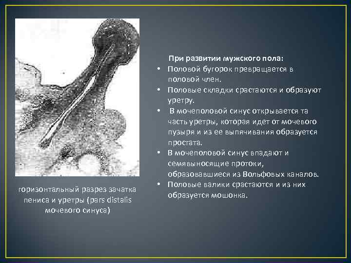 горизонтальный разрез зачатка пениса и уретры (pars distalis мочевого синуса) При развитии мужского пола: