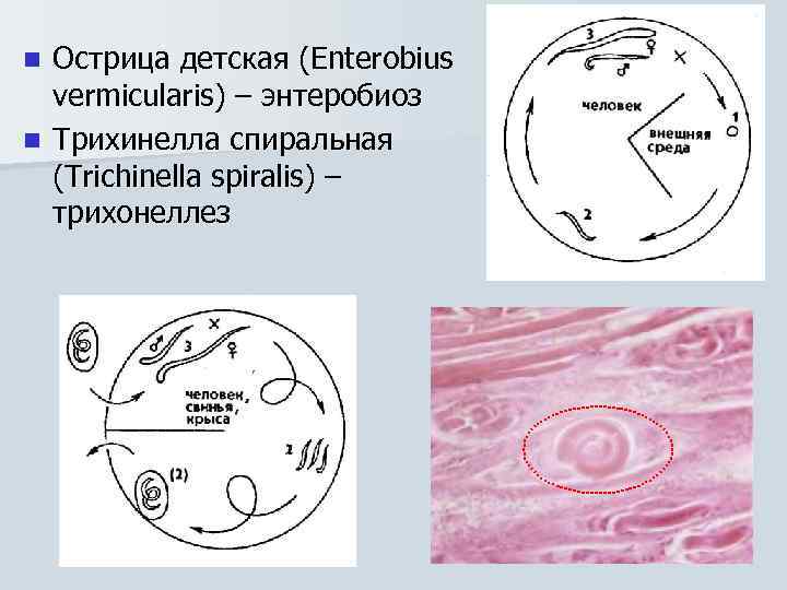 Острица детская (Enterobius vermicularis) – энтеробиоз n Трихинелла спиральная (Trichinella spiralis) – трихонеллез n