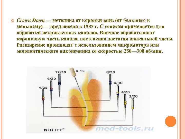 Степ бэк схема