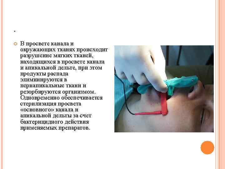 . В просвете канала и окружающих тканях происходит разрушение мягких тканей, находящихся в просвете