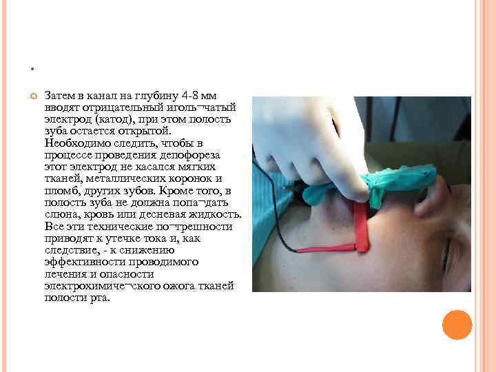 . Затем в канал на глубину 4 -8 мм вводят отрицательный иголь¬чатый электрод (катод),