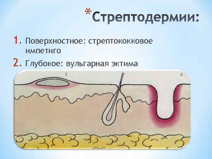 Лечение стрептодермии у детей схема