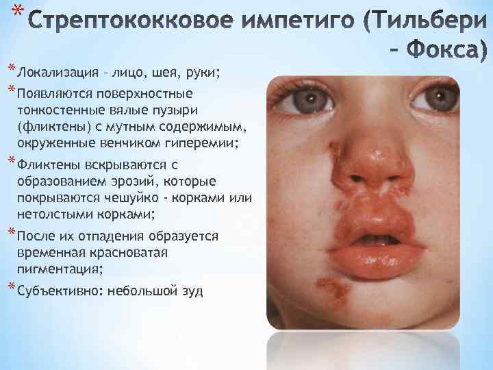 * * Локализация – лицо, шея, руки; * Появляются поверхностные тонкостенные вялые пузыри (фликтены)