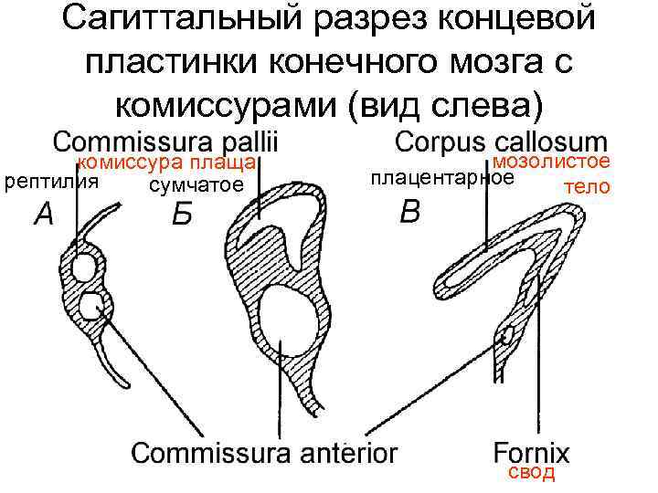 Сагиттальный разрез концевой пластинки конечного мозга с комиссурами (вид слева) комиссура плаща рептилия сумчатое