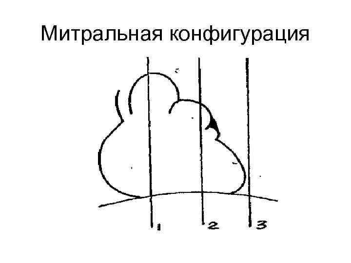 Нормальная конфигурация сердца рисунок