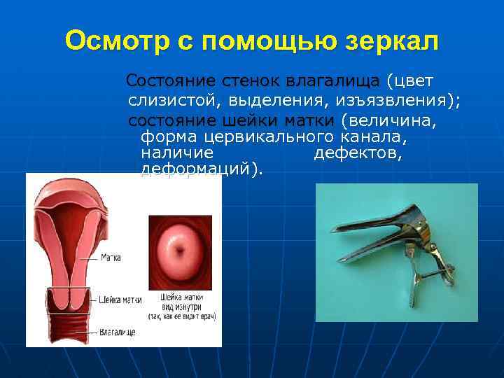 Осмотр с помощью зеркал Состояние стенок влагалища (цвет слизистой, выделения, изъязвления); состояние шейки матки