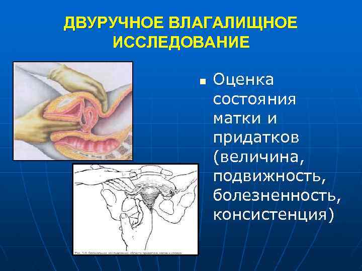 Влагалищное исследование