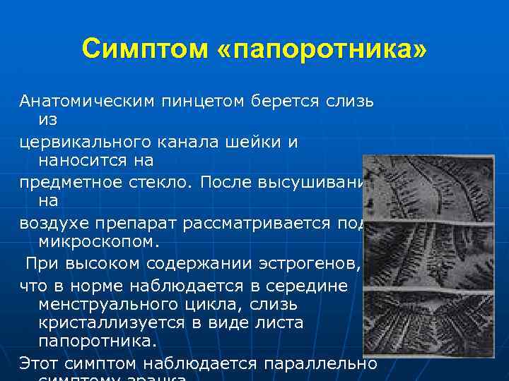 Симптом «папоротника» Анатомическим пинцетом берется слизь из цервикального канала шейки и наносится на предметное
