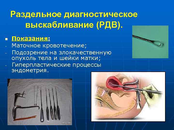 Раздельное диагностическое выскабливание (РДВ). n - Показания: Маточное кровотечение; Подозрение на злокачественную опухоль тела