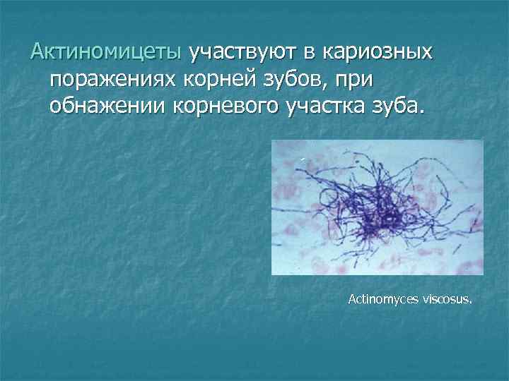 Актиномицеты участвуют в кариозных поражениях корней зубов, при обнажении корневого участка зуба. Actinomyces viscosus.