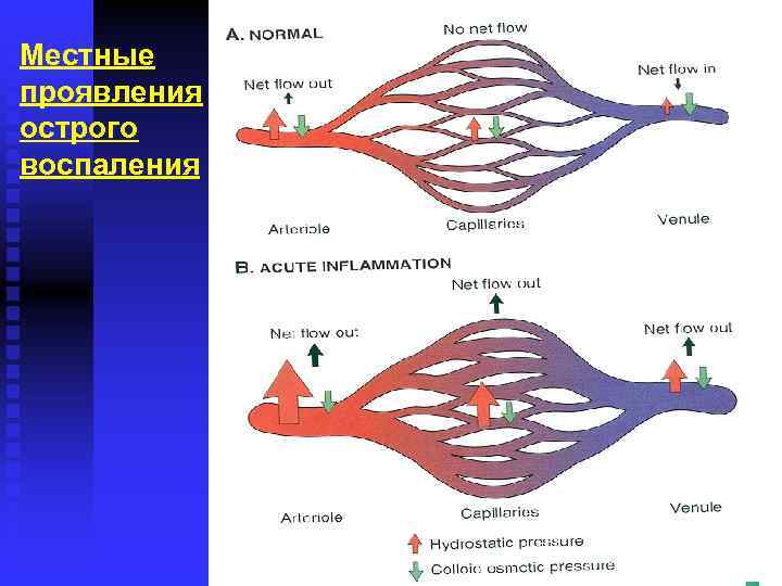 Местные проявления острого воспаления 
