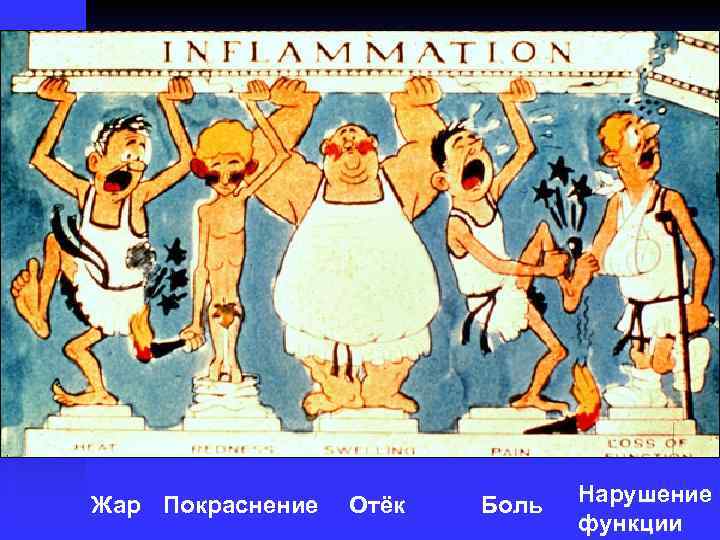 Жар Покраснение Отёк Боль Нарушение функции 
