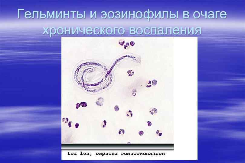 Гельминты и эозинофилы в очаге хронического воспаления 