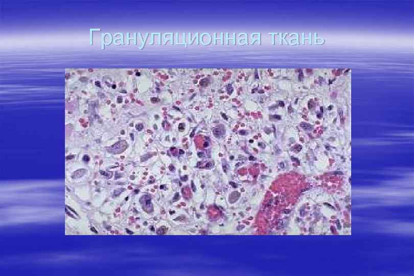 Грануляционная ткань 