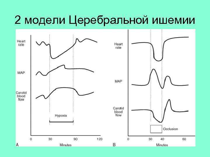 2 модели Церебральной ишемии 