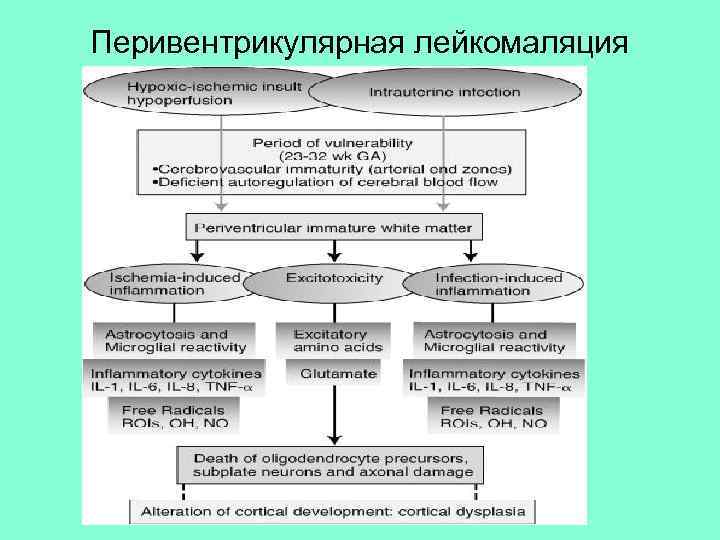 Перивентрикулярная лейкомаляция 