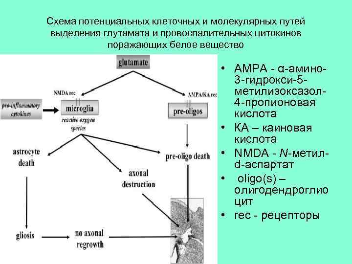Схема потенциальных клеточных и молекулярных путей выделения глутамата и провоспалительных цитокинов поражающих белое вещество