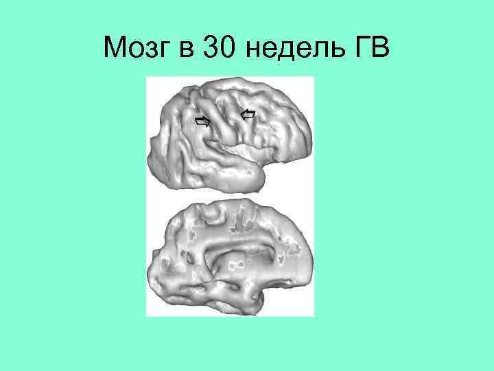 Мозг в 30 недель ГВ 
