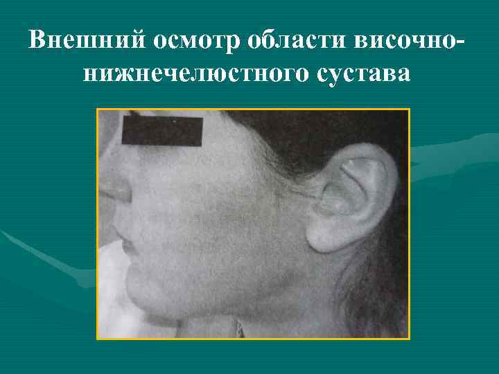 Внешний осмотр области височнонижнечелюстного сустава 