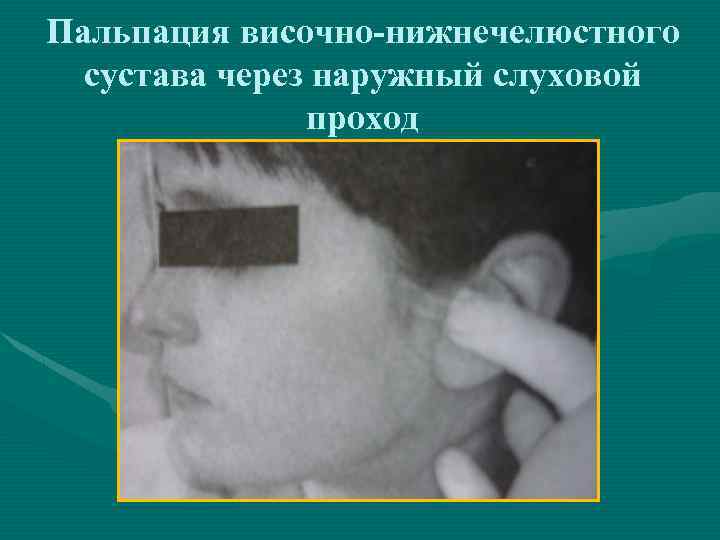 Пальпация височно-нижнечелюстного сустава через наружный слуховой проход 