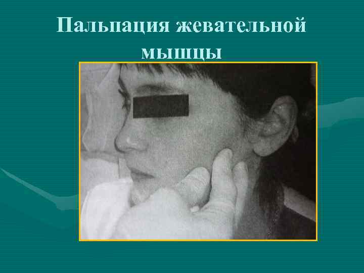 Пальпация жевательной мышцы 