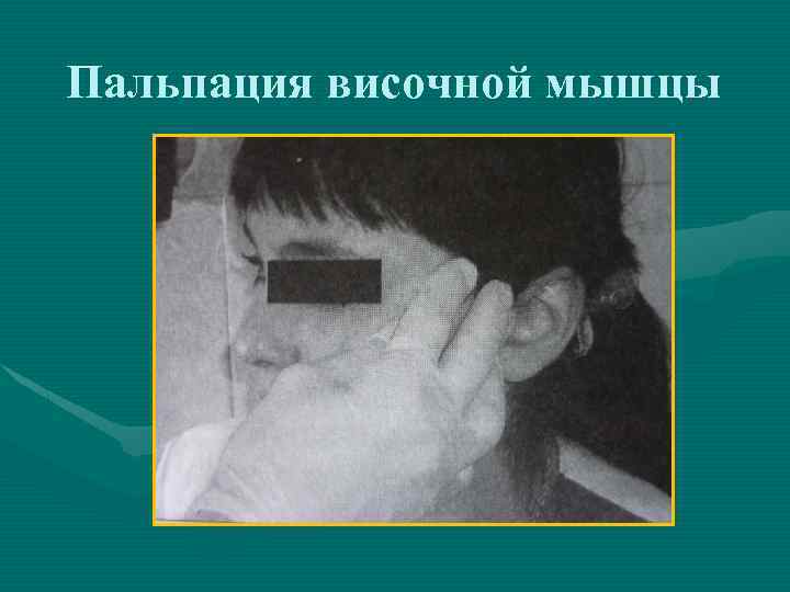 Пальпация височной мышцы 
