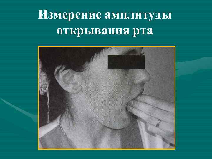 Измерение амплитуды открывания рта 