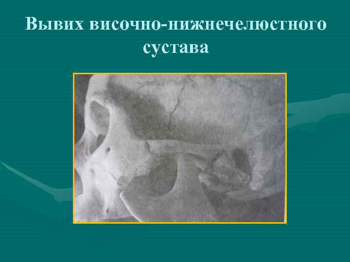 Лучевая диагностика внчс презентация