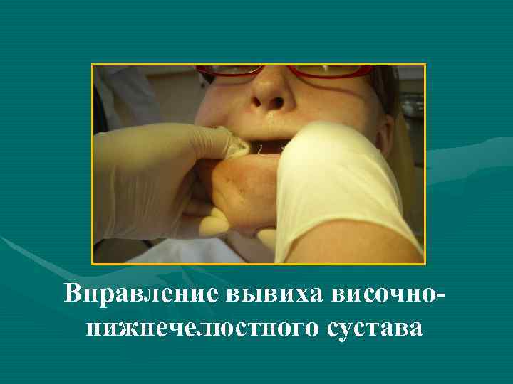 Вправление вывиха височнонижнечелюстного сустава 