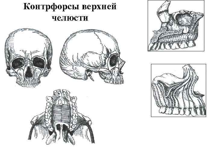 Контрфорсы верхней челюсти 