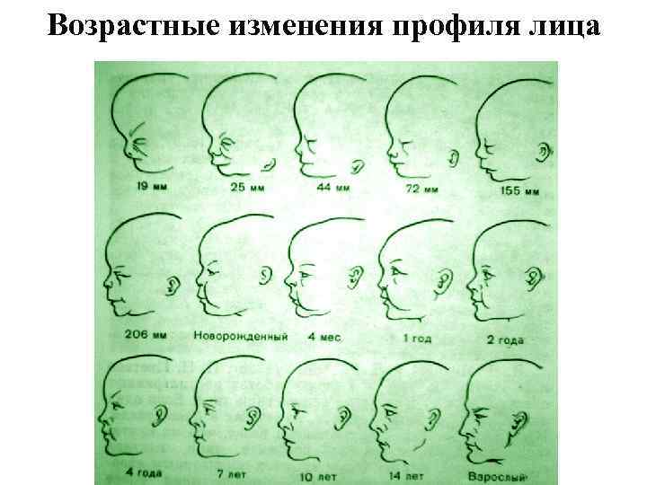 Возрастные изменения профиля лица 