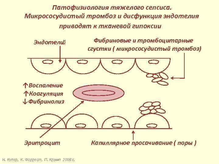 Патофизиология тяжелого сепсиса. Микрососудистый тромбоз и дисфункция эндотелия приводят к тканевой гипоксии. Эндотели й