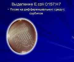 Выделение E. coli O 157: H 7 - Посев на дифференциальную среду с сорбитом