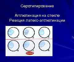 Серотипирование Агглютинация на стекле Реакция латекс-агглютинации 