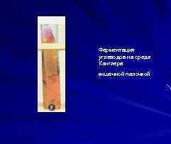 Ферментация углеводов на среде Клиглера кишечной палочкой 