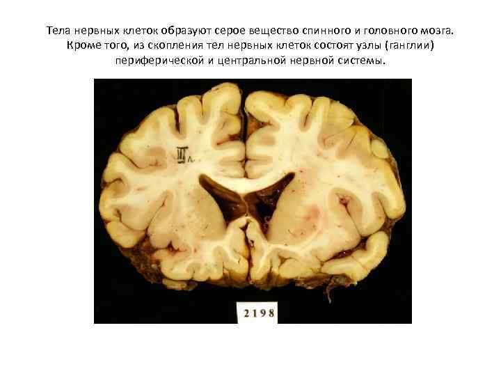 Воспаление серого вещества мозга латынь